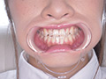 「【口内・歯・舌フェチ】桐山結羽ちゃんのとっても貴重な歯・口内・舌フェチ動画！！」のサンプル画像5