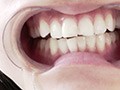 「【歯・舌ベロ】素人モデル まみチャンの歯・舌ベロ観察☆」のサンプル画像17