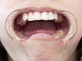 「【歯・舌ベロ】素人モデル まみチャンの歯・舌ベロ観察☆」のサンプル画像19