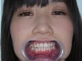 「人気女優 須崎美羽チャンの開口器で歯観察＆M男顔舐め鼻フェラプレイ！」のサンプル画像3