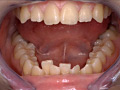 「歯15」のサンプル画像10