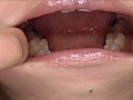 「歯15」のサンプル画像4