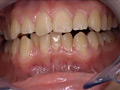 「歯15」のサンプル画像7