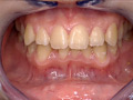 「歯15」のサンプル画像9