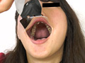 「歯、痛いですか？ 素人娘たちの意識調査」のサンプル画像11