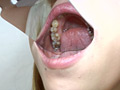 「歯、痛いですか？ 素人娘たちの意識調査」のサンプル画像13