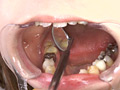 「歯、痛いですか？ 素人娘たちの意識調査」のサンプル画像15
