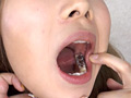 「歯、痛いですか？ 素人娘たちの意識調査」のサンプル画像5