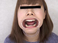 「歯、痛いですか？ 素人娘たちの意識調査」のサンプル画像6