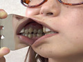 「歯、痛いですか？ 素人娘たちの意識調査」のサンプル画像8