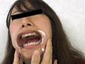 「歯、痛いですか？ 素人娘たちの意識調査」のサンプル画像9