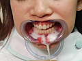 「歯科衛生女子 淫 口内観察」のサンプル画像12